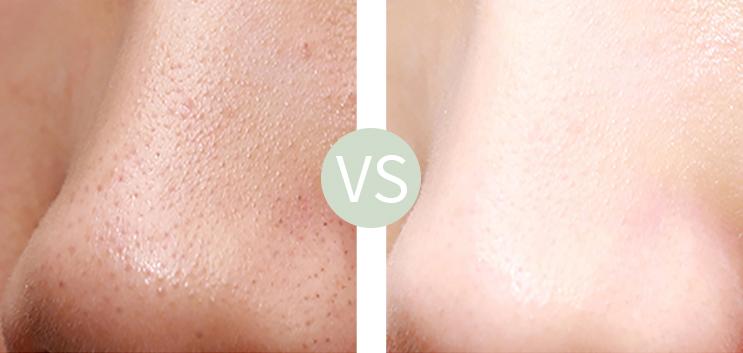 张韶涵晒护肤全过程,张韶涵冻龄秘诀真的有用吗