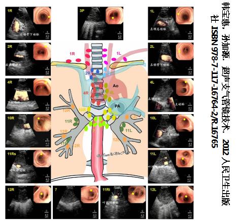 孙加源门诊,治疗肺癌的新技术新手段