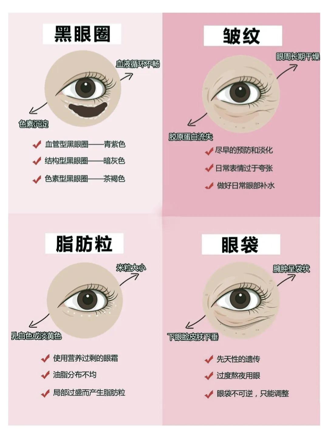 黑眼圈眼袋脂肪粒怎么去除,黑眼圈有纹有脂肪粒用什么