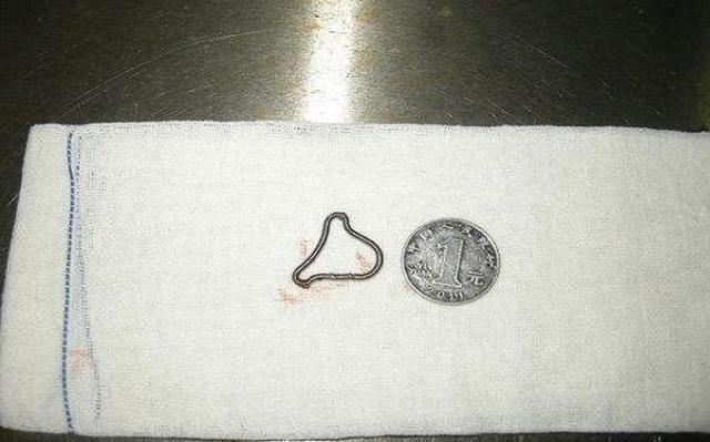 给女性上环到底正不正确,上环避孕的副作用