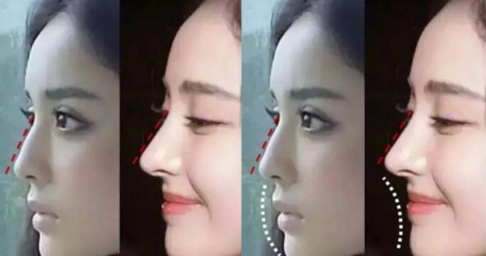 面部一枝花全靠鼻当家，论鼻子对颜值的重要性▼