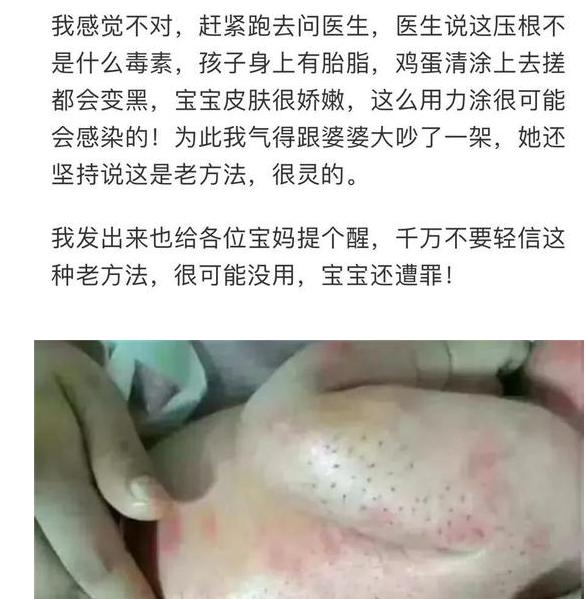 孩子被送医院治疗黄疸,婴儿黄疸长刺