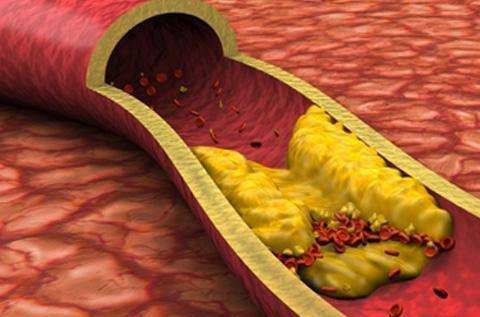体重超标的胖子，会营养不良？营养师：跟大家喜欢做的一件事有关