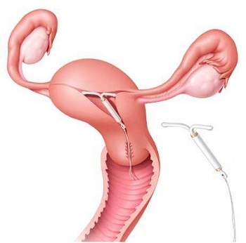 月经量减少的鉴别诊断,月经变少怎么调理气血