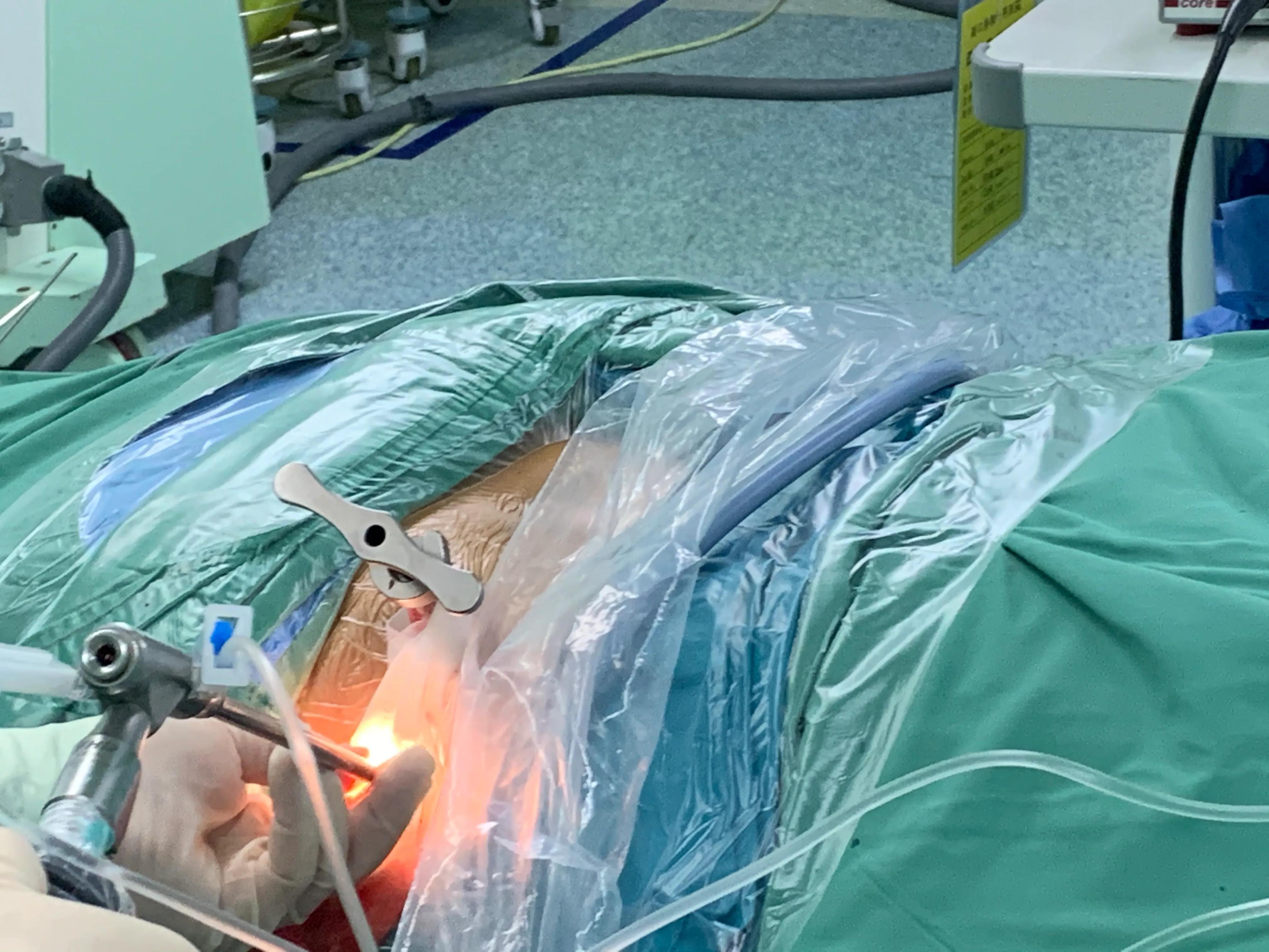 椎间孔镜术后腰痛症状多久消失,盘源性腰痛手术后易复发吗