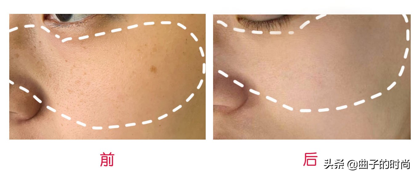 祛斑一个月了怎么还没有好,最可靠也最有效的祛斑方法