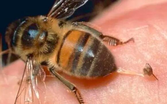 被蜜蜂蛰了饮食需要忌口吗,被蜜蜂蛰了饮食注意什么