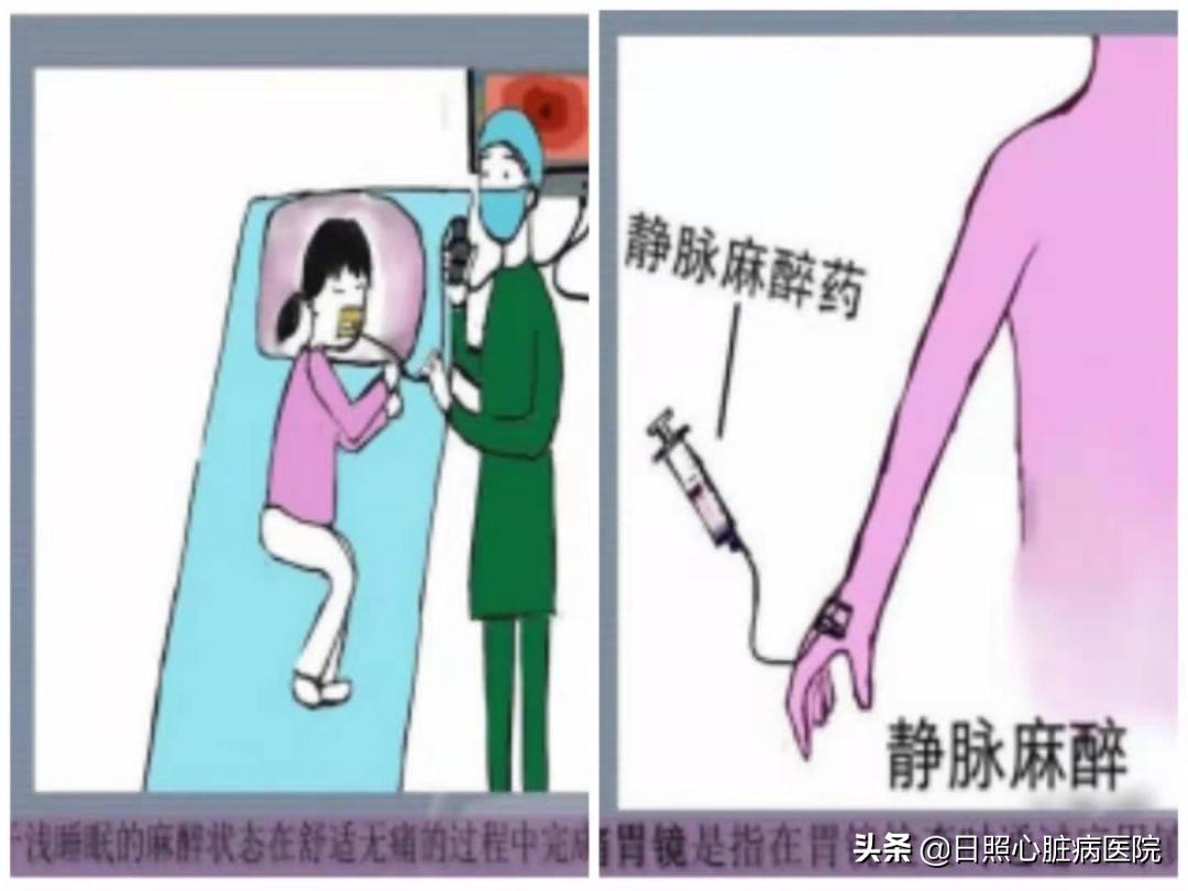 原来胃肠镜检查可以如此轻松,真实胃肠镜