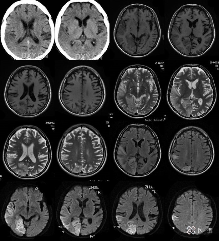 iseihealth:为什么即使在绝经后，每年的检查也是必要的