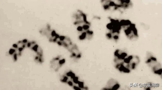 遭遇核辐射死得最惨的人,日本被核辐射致死的人