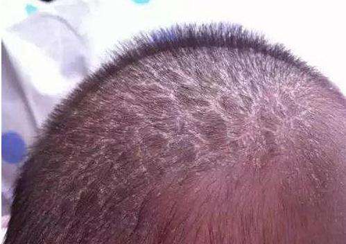 人体有5个部位不要清洗太干净,宝宝身上弄的油污怎么洗