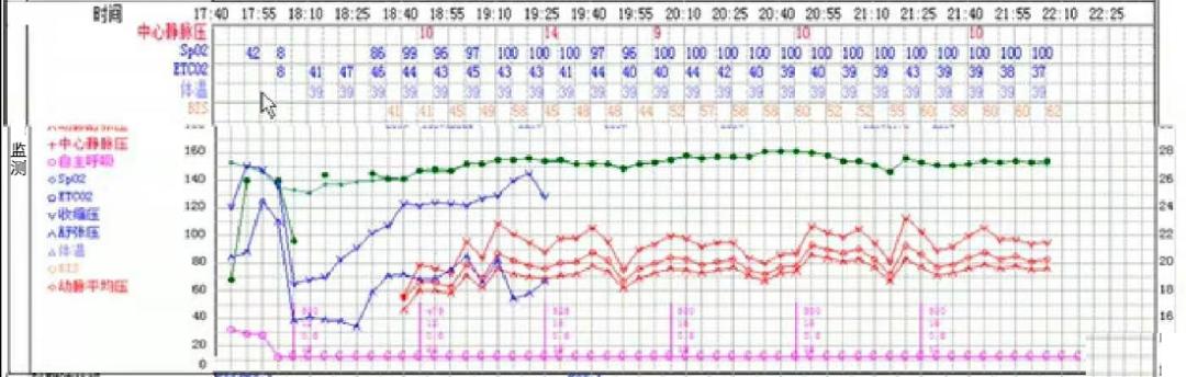 一例感染性休克患者的麻醉处理