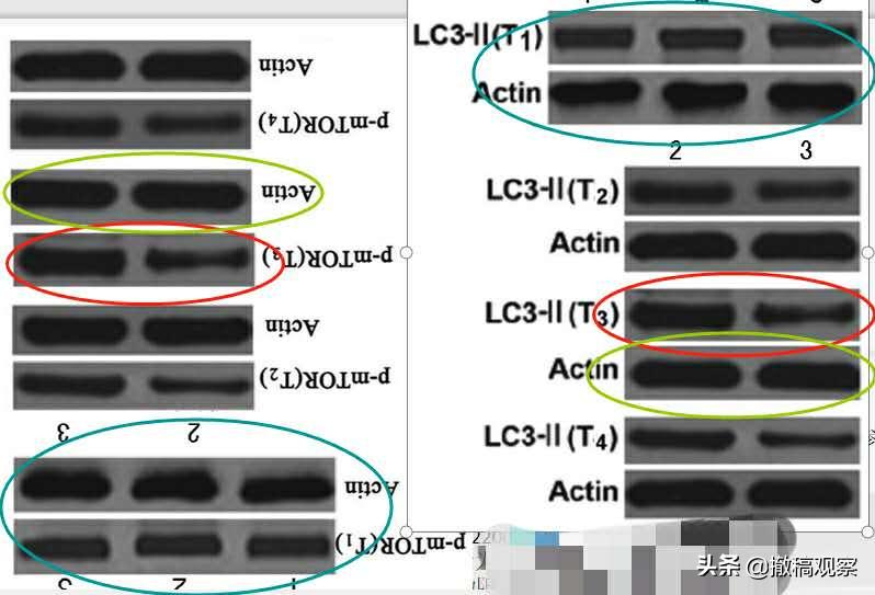 中国全科医学杂志退稿快吗,中国医学论文被撤名单