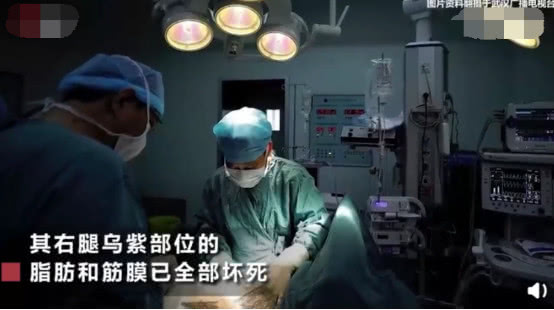 女童被蚊虫叮咬,女童被蚊子咬了肿好大怎么处理