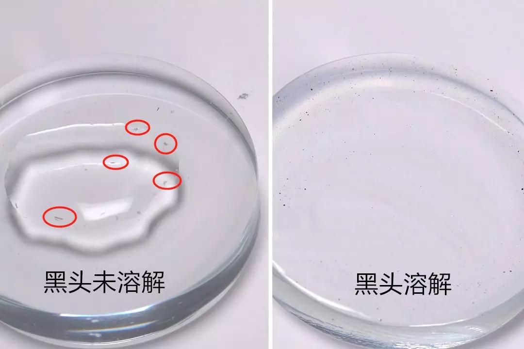 有黑头和没黑头有什么区别,没有长过黑头却长黑头怎么办