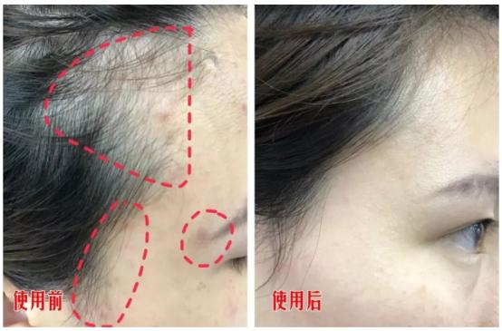 澳洲茶树精油洗发水去头屑,头发一摸全是油