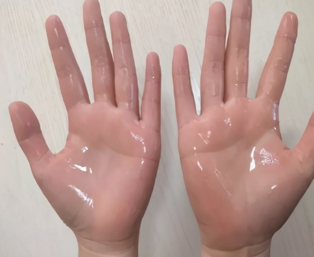 儿童手汗症多大可以手术,手汗症手术全过程小孩