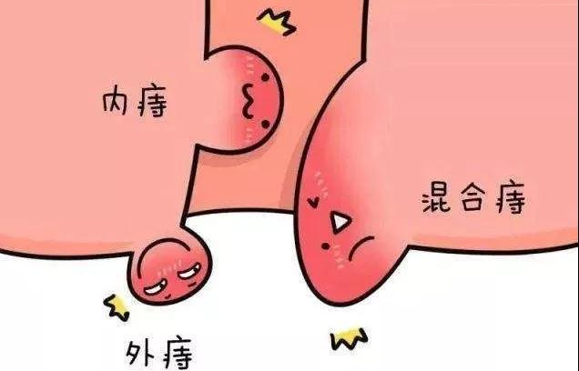 肛门潮湿是怎么回事吃啥中成药,肛门潮湿是怎么回事啊