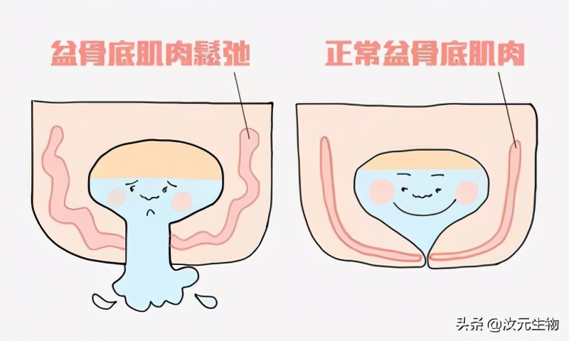 产后恢复漏尿教程,产后漏尿康复操