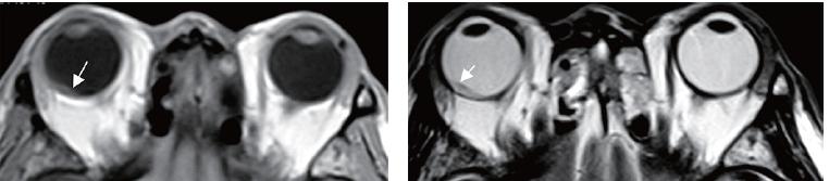 眼科医生和影像医生哪个好,真正的眼科医生