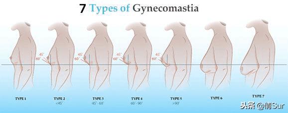 当你的胸比女朋友还大的时候,就要引起注意了……