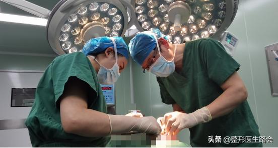 拉皮去法令纹怎么去除最安全永久,做拉皮能去除法令纹能坚持多久