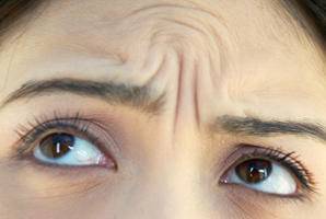 如何消除眼角皱纹和抬头纹的方法,消除川字纹和抬头纹最有效的方法
