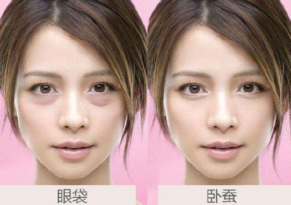 眼睛黑眼圈显老怎么办,眼睛黑眼圈大眼袋怎么消除