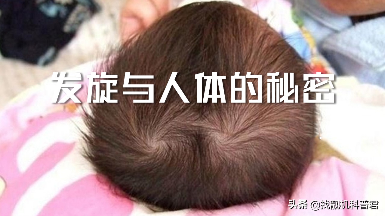 有两个发旋的人智商,发旋会遗传吗