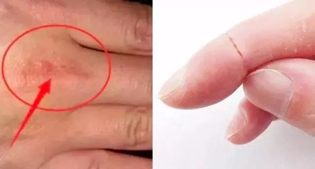 羽绒服有点黄怎么洗白,羽绒服又脏又油怎么洗