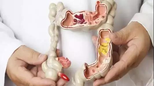 肛门塞异物很刺激？医生忙说：别乱来，快感之后全是悲伤