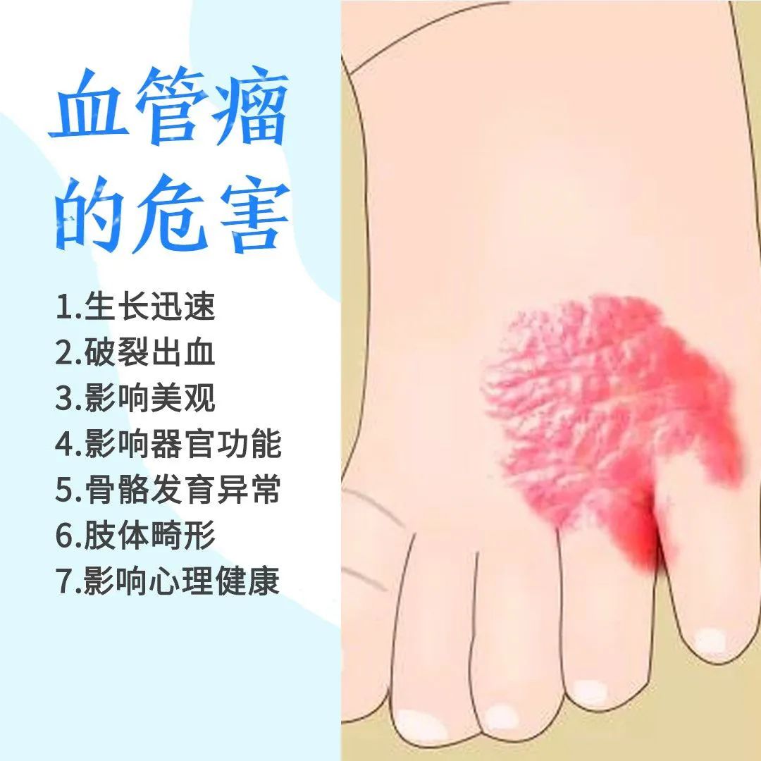 宝宝有一块红胎记是血管瘤吗,新生儿红胎记正常吗