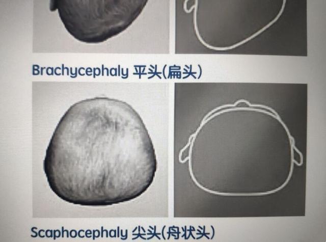 岳云鹏老婆再剃光头,岳云鹏老婆为什么剃光头