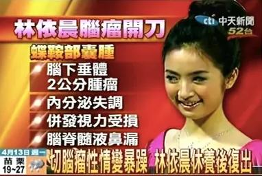 林依晨幻灭史7年嫁豪门,“童年女神”林依晨的幻灭史