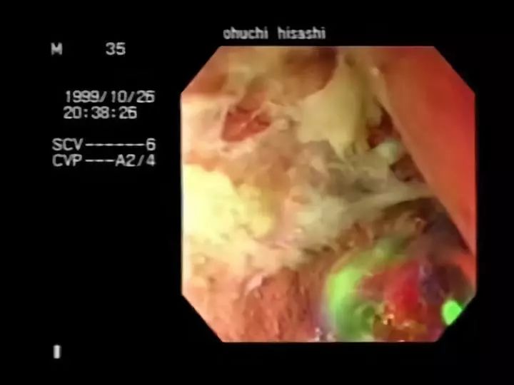 83天核事故救治纪录片,核灾83天死亡全记录