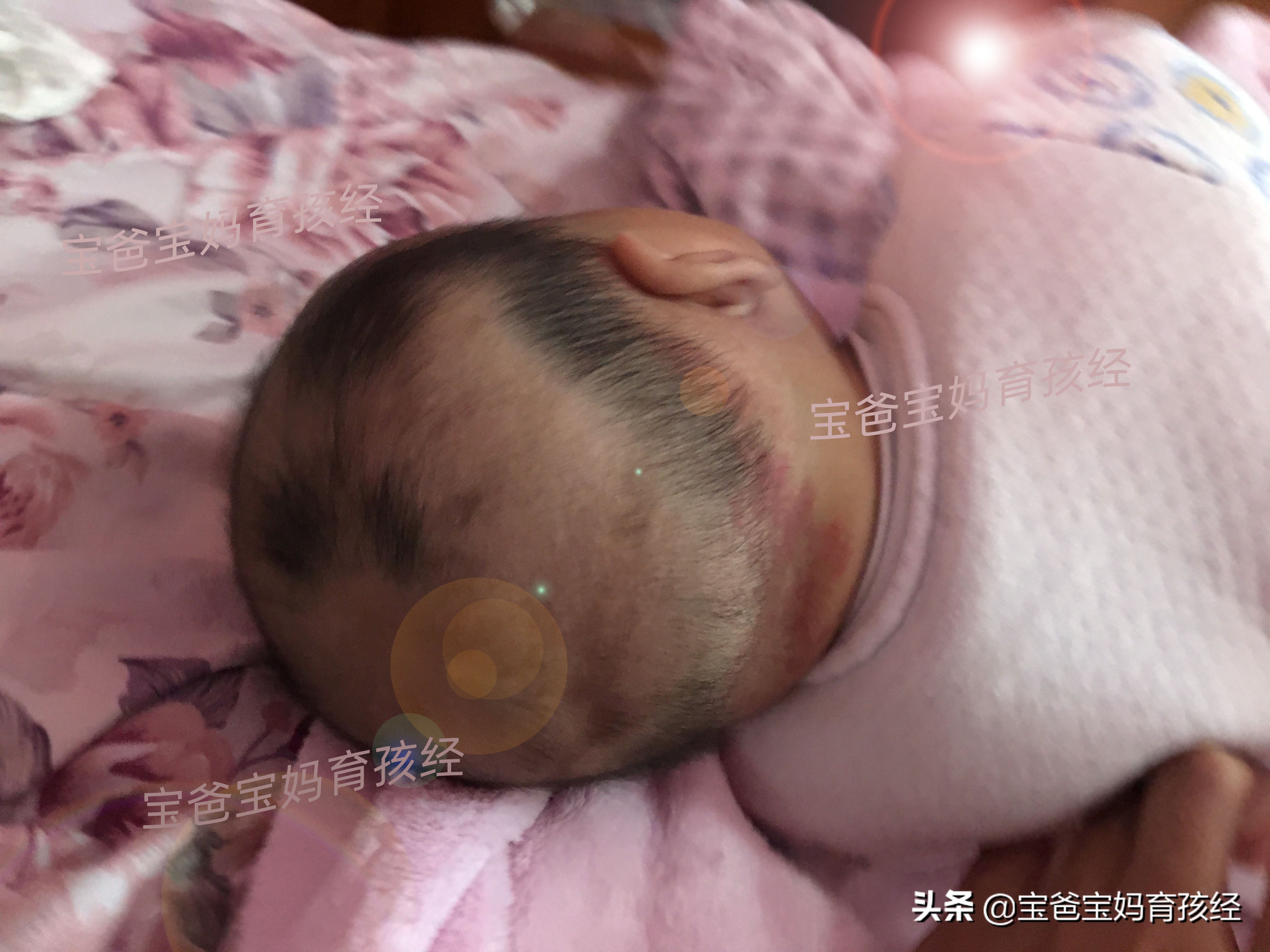 严重掉发怎么办每天都掉好多头发,头发又细又软还掉发严重怎么回事