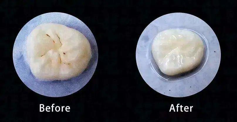 儿童没换的牙齿蛀了可以补吗,儿童牙齿蛀了会痛需要补牙吗