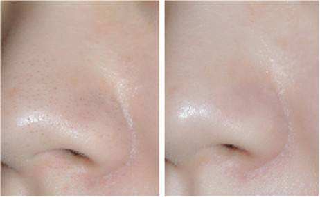 赵丽颖皮肤毛孔粗大图片,赵丽颖无美颜无滤镜最真实的模样