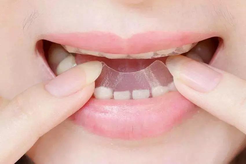 牙黄最有效变白方法,女性牙黄最有效的方法