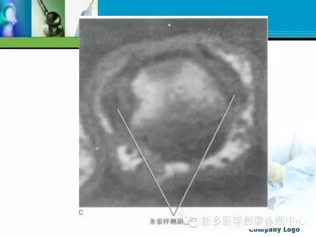 单只手指磁共振,手指用磁共振能做出来结果吗