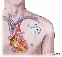 经常心慌怎么办,晚上经常会心慌