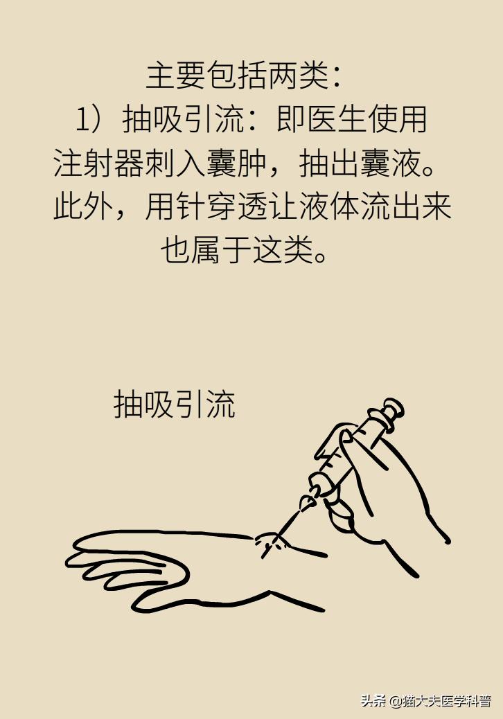 手腕长腱鞘囊肿,手腕上有个凸起的包腱鞘囊肿