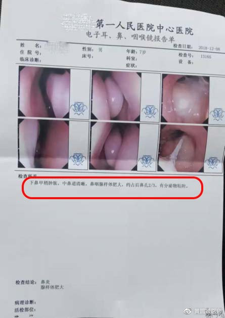 孩子长不高很瘦吃什么钙片,长不高缺钙应该吃什么