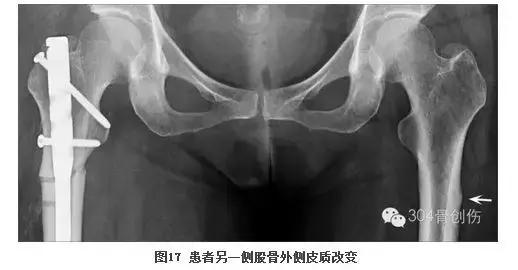 循证医学学习指导,循证医学连续病例