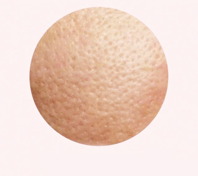 皮肤屏障受损就是敏感肌怎么护肤,屏障受损修复平价护肤产品有用吗