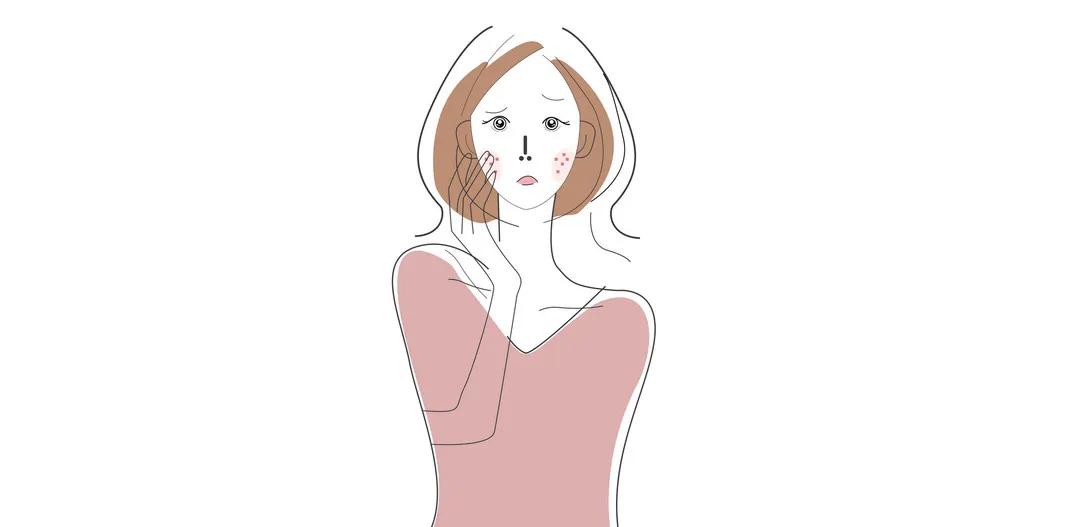 肺癌吃靶向药皮肤痒是怎么回事 (如何解决靶向药带来的皮肤瘙痒)