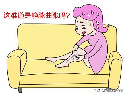 孕期怎么避免静脉曲张,孕期腿上的静脉曲张更严重了