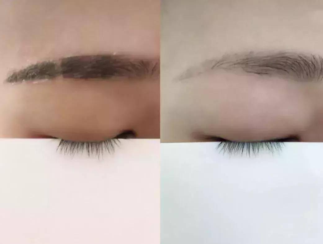 欧阳娜娜擦什么药膏好,欧阳娜娜安利祛疤膏