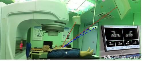 预测癌症免疫治疗效果的方法,预防免疫治疗癌症最新突破