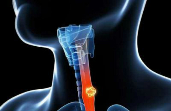 老人肺部感染被下病危,六旬大叔肺部感染